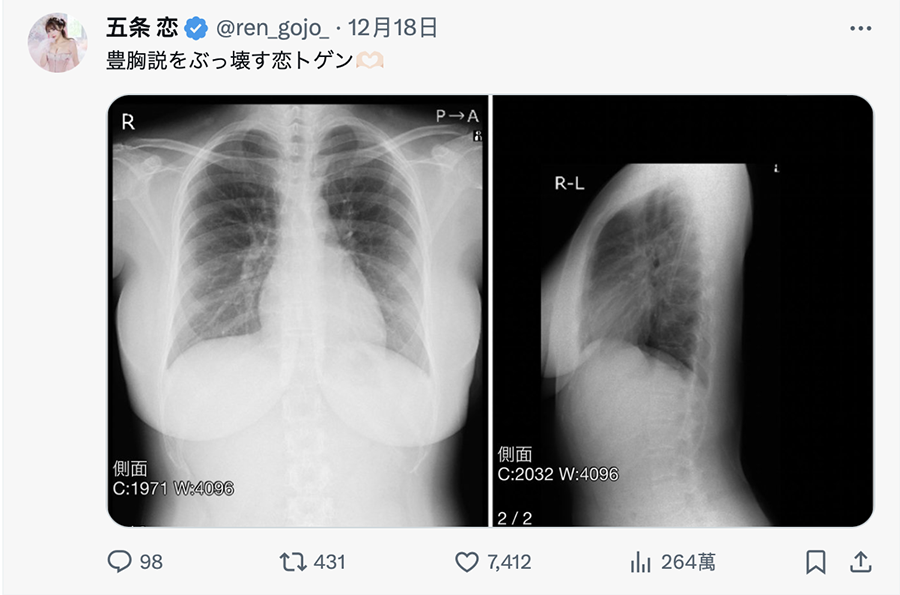 图片[8]_TSE最胸战士！五条恋(五条恋)不是一片限定！_探号社